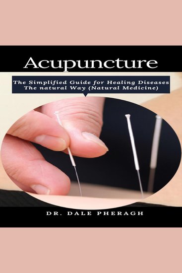 Acupuncture: The Simplified Guide for Healing Diseases The natural Way (Natural Medicine) - cover