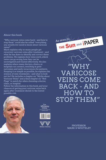 Why Varicose Veins Come Back – and How to Stop Them - cover